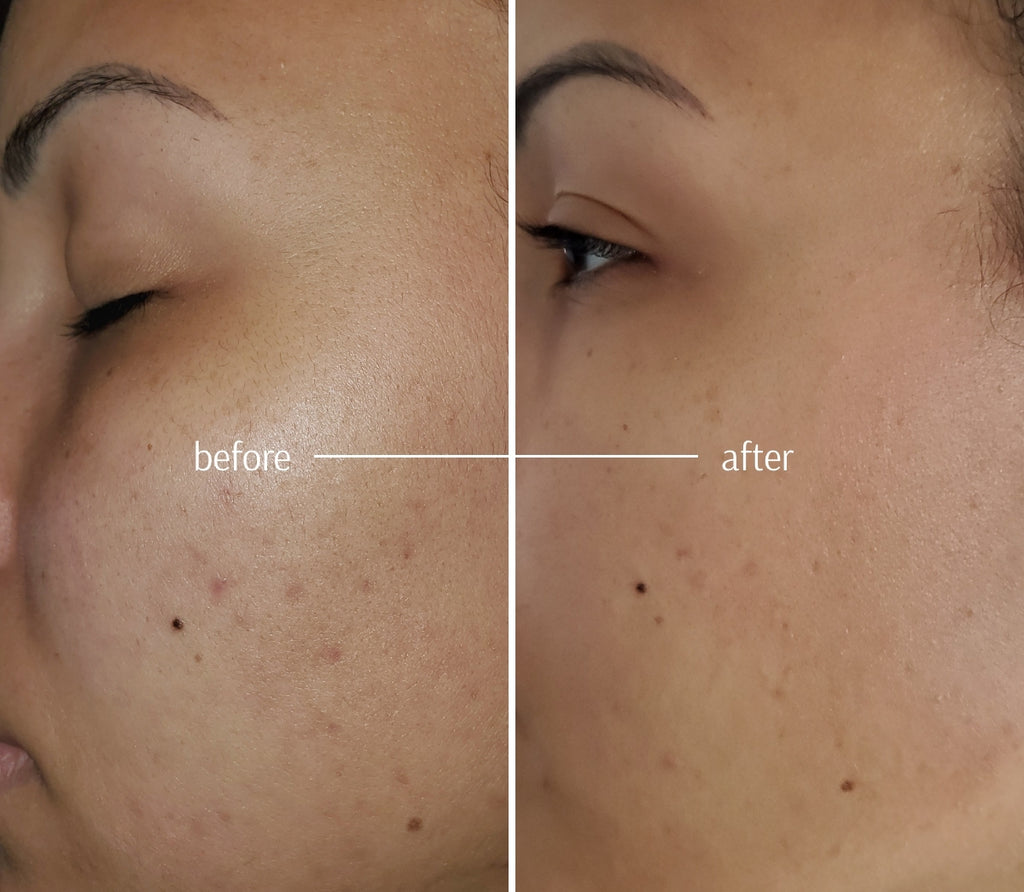 Deep Cleansing Clay Mask